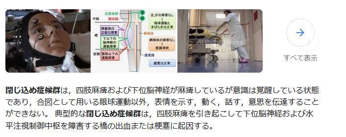 「閉じ込め症候群」患者とのコミュニケーションに成功：「生きていてうれしい」